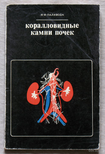 Коралловидные камни почек.