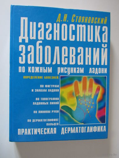 Диагностика заболеваний по кожным рисункам ладони.